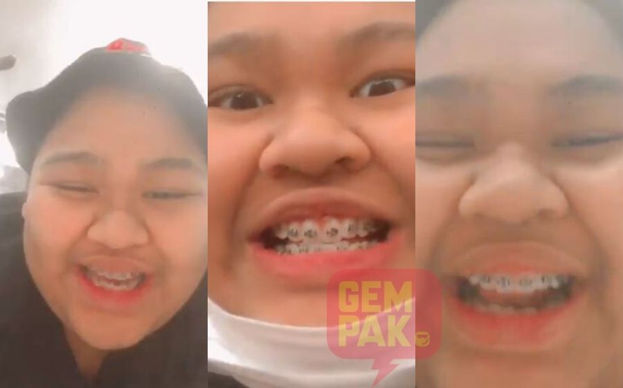 Comelll Sakit Sikit Je Nanti Tu Cik B Teruja Pakai Pendakap Gigi Gempak