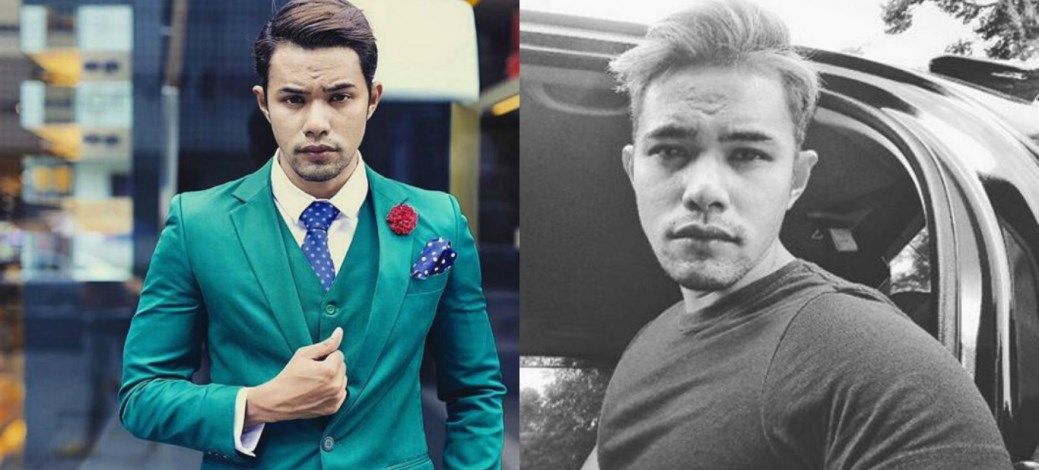 Hafreez Adam Akui Kecil Hati Kerana Isu Jerawat Batu