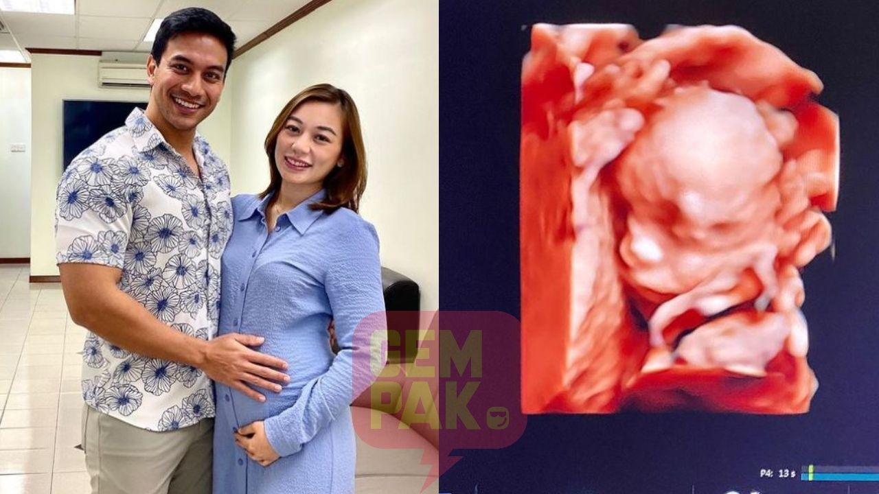 Kerap Gastrik Hidung Tersumbat Dan Penat Melampau Hamil Lima Bulan Dr Say Risau Isteri Tak Lalu Makan Gempak