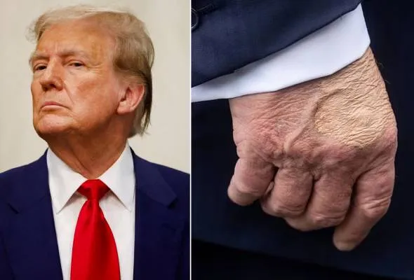 71752790833_DonaldTrumpUSPre.jpg