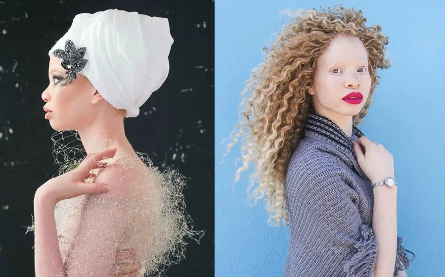 albino.jpg