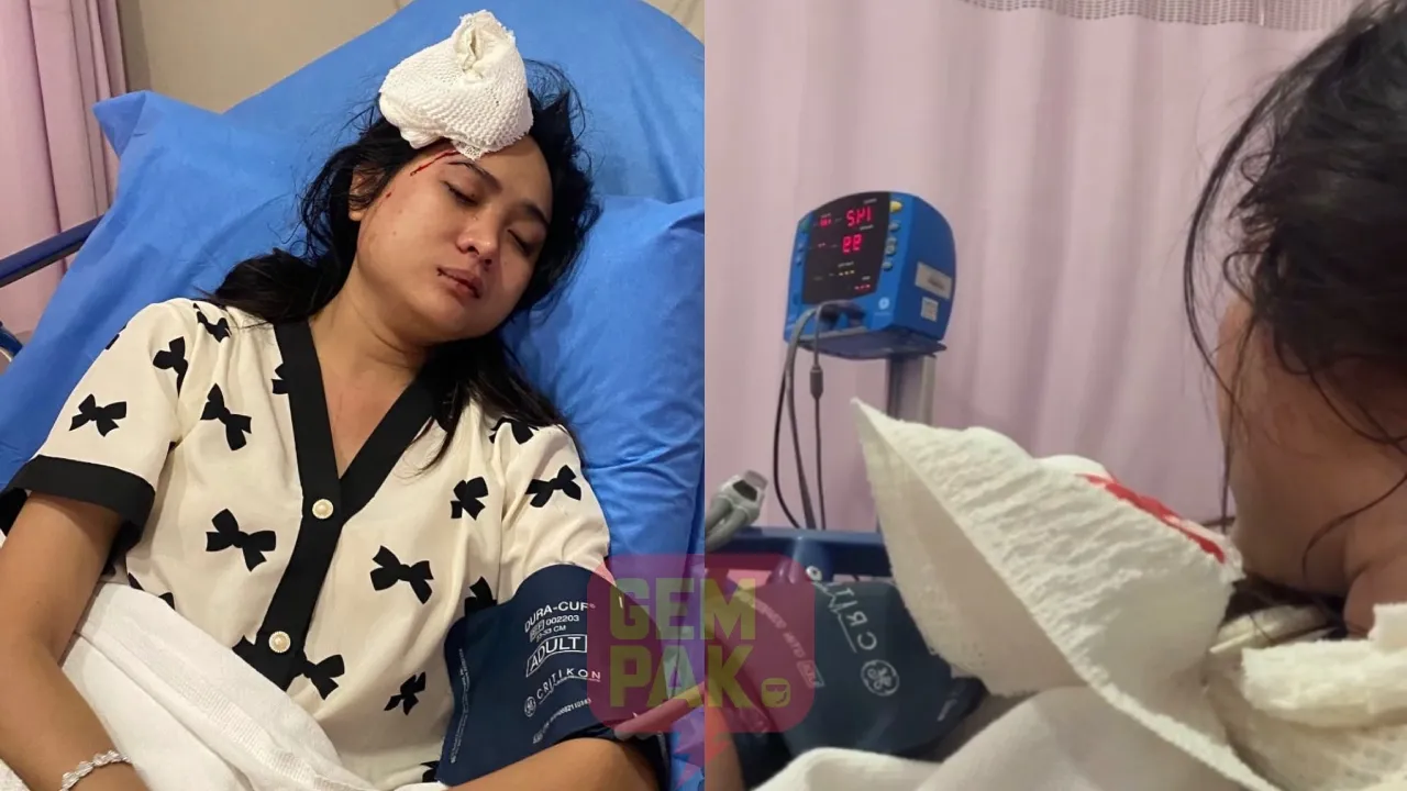 Didi Astillah jatuh tangga