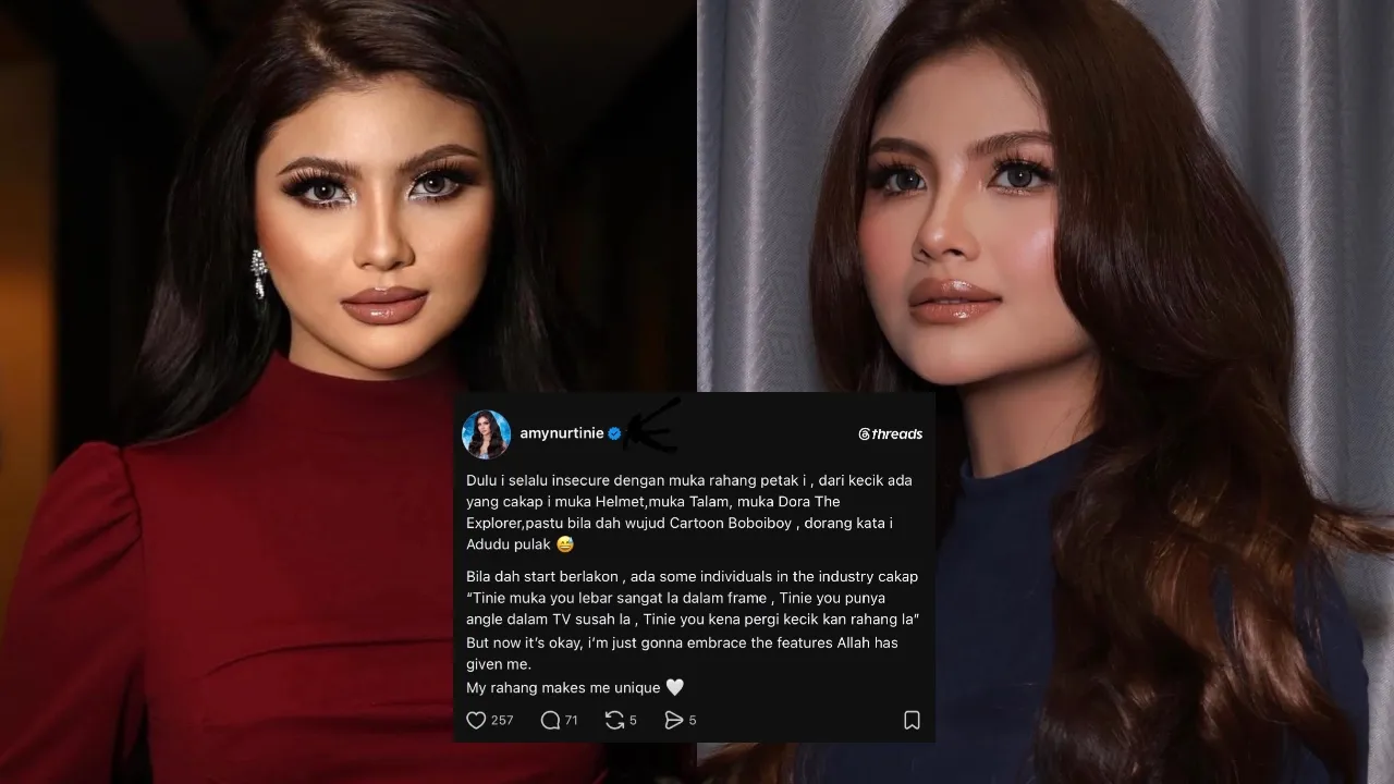 Amy Nurtinie pernah dihina sebab rahang