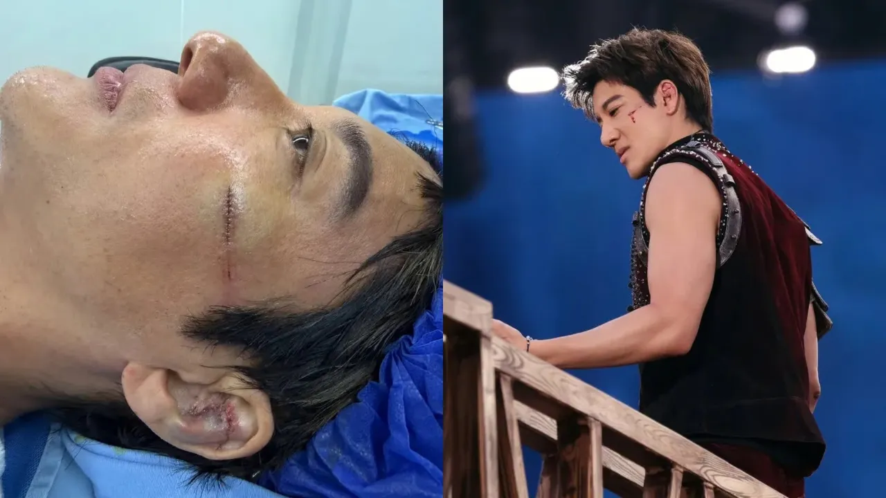 "Tulang Rawan Telinga Saya Pecah" - Wang Leehom Terima 39 Jahitan Terjatuh Di Pentas, Tahan Sakit Teruskan Show!
