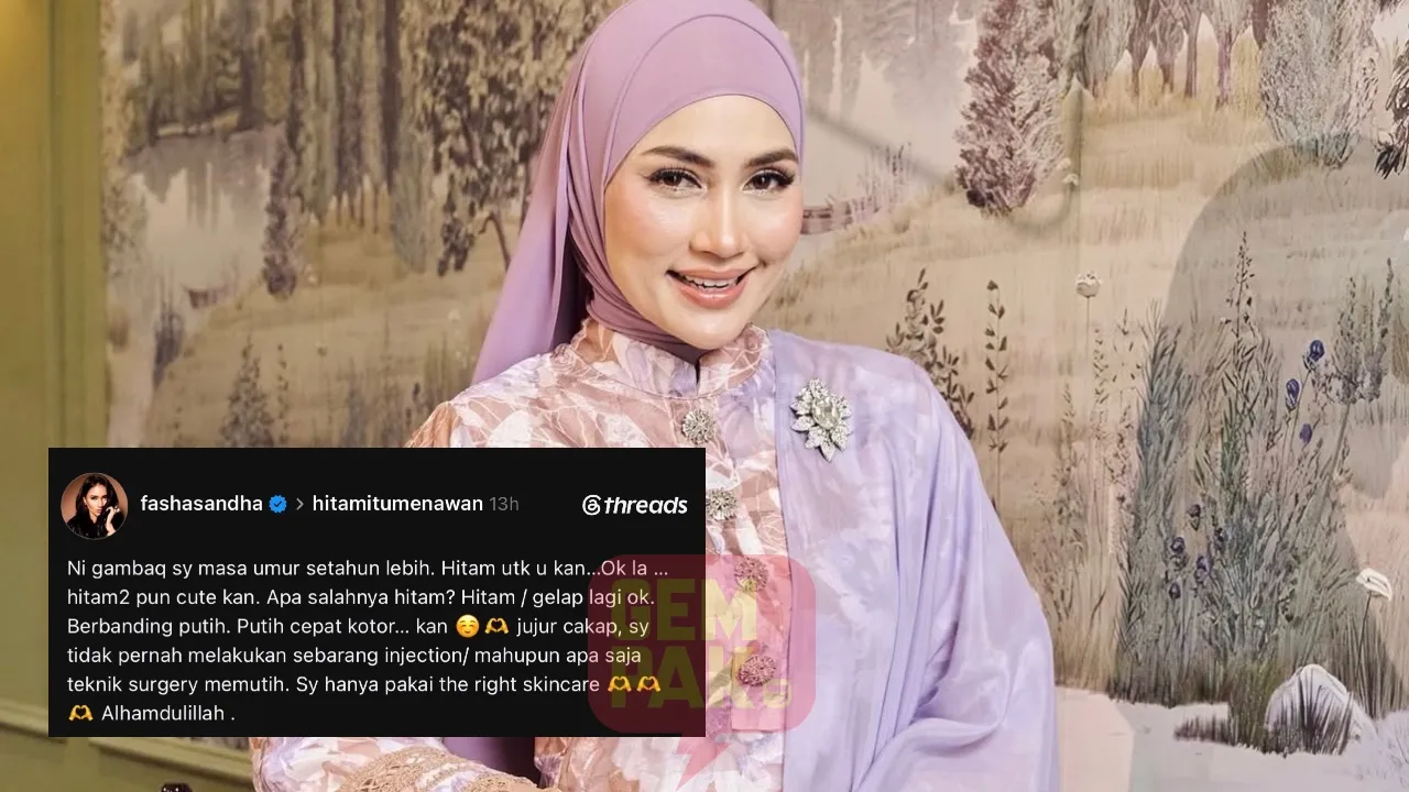 Fasha Sandha tak ambil suntikan kecantikan