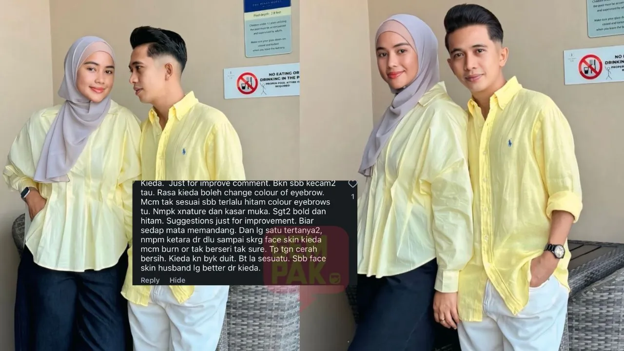 Netizen Tegur Warna Kening Terlalu Hitam, Wajah Tak Berseri, Kieda Crepe Bersuara - “Saya Tak Perlu Pendapat Orang…”
