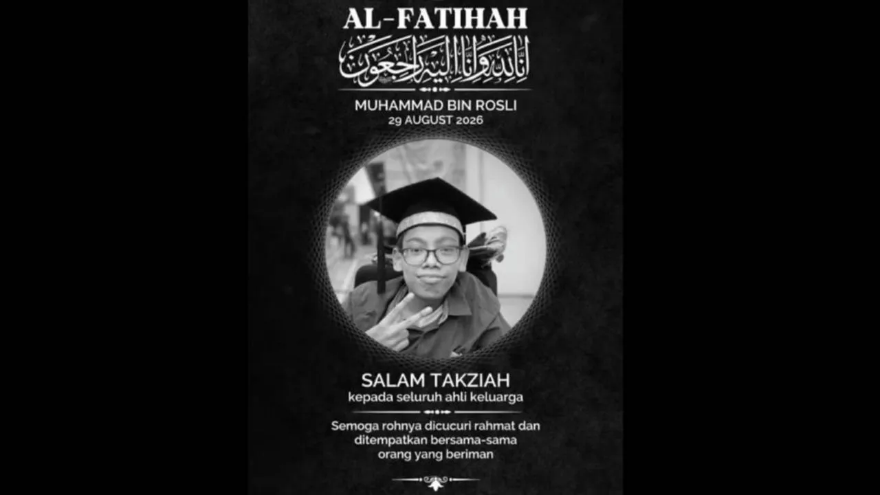 Kembar Siam Muhammad Yang Dipisahkan Di Arab Saudi, Meninggal Dunia