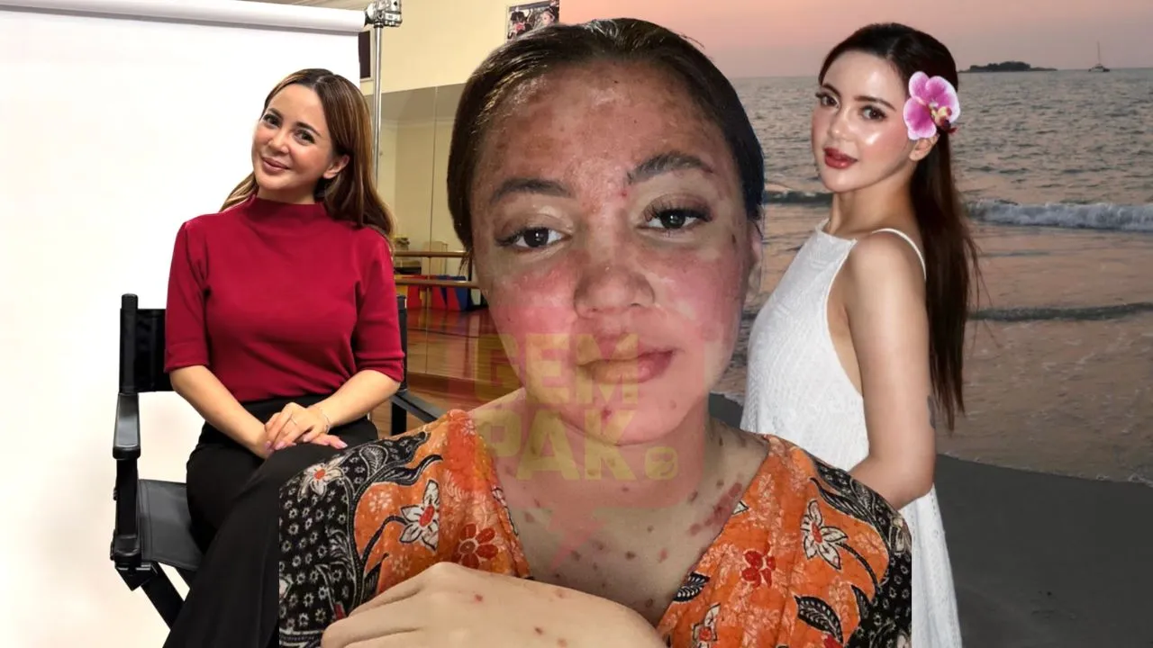 Sharmaine mengakui dia jarang berkongsi tentang kehidupan peribadinya namun dia terpaksa kerana tuduhan yang dilemparkan sudah melampaui batas. Sekarang beritahu saya, siapa yang suka berkongsi kesusahan mereka? Bukan semua orang.