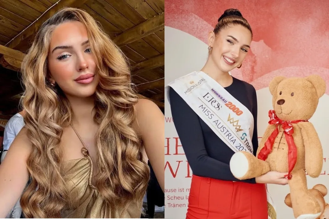 Pernah Dedah Doktor Beberapa Kali Selamatkan Nyawanya, Miss Austria Meninggal Dunia Usia 22 Tahun