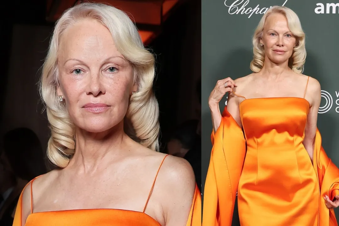 Dijangkiti Hepatitis C Kongsi Jarum Cacah Tato, Pamela Anderson Diramal Hanya Hidup 10 Tahun