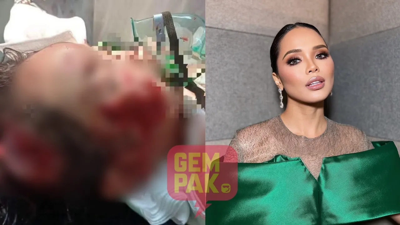 “Aku Didik Anak Aku Untuk Takut Anjing Liar” - Ain Edruce