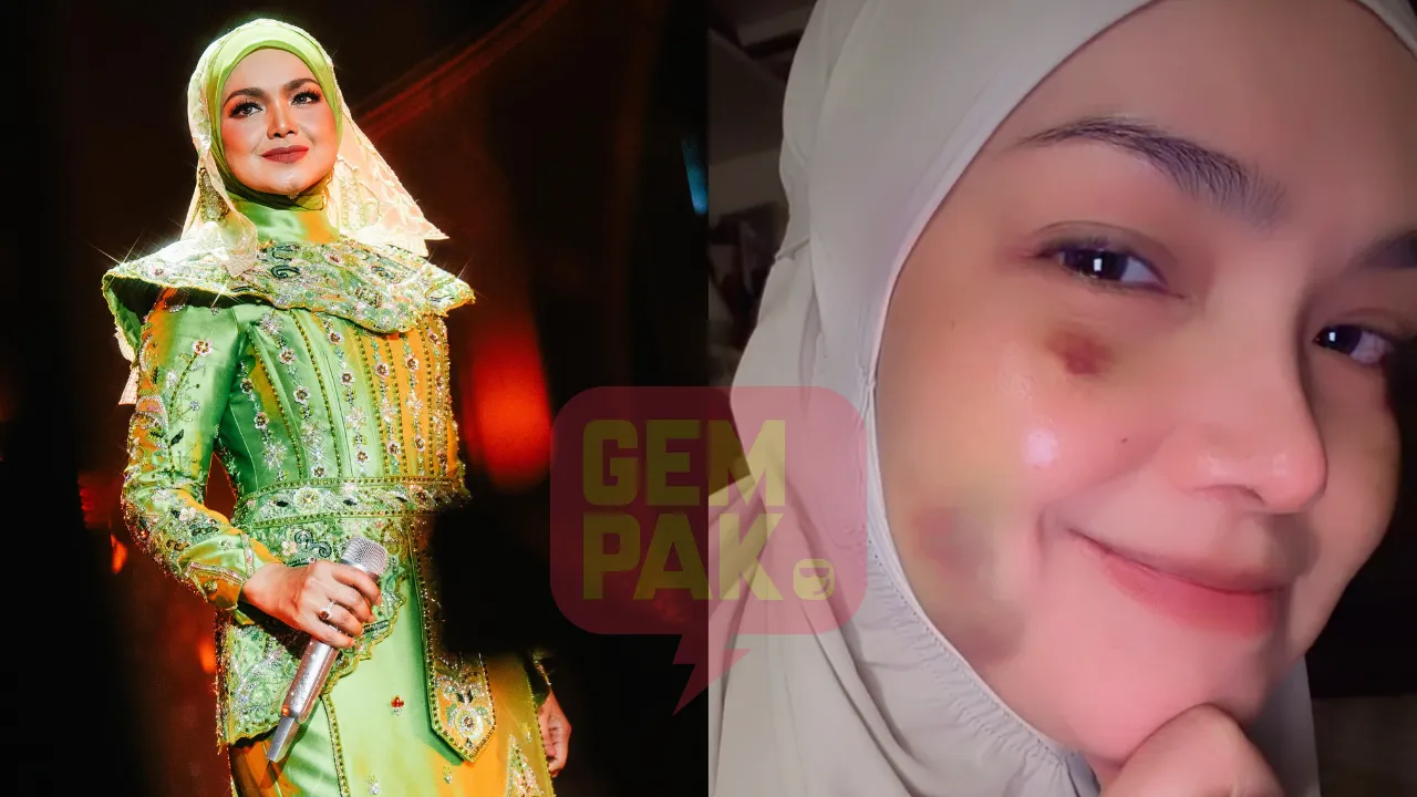 “Tinggal Nak Hilangkan Lebam” - Siti Nurhaliza Kongsi Perkembangan Terkini Selepas Terjatuh Ketika Latihan Konsert