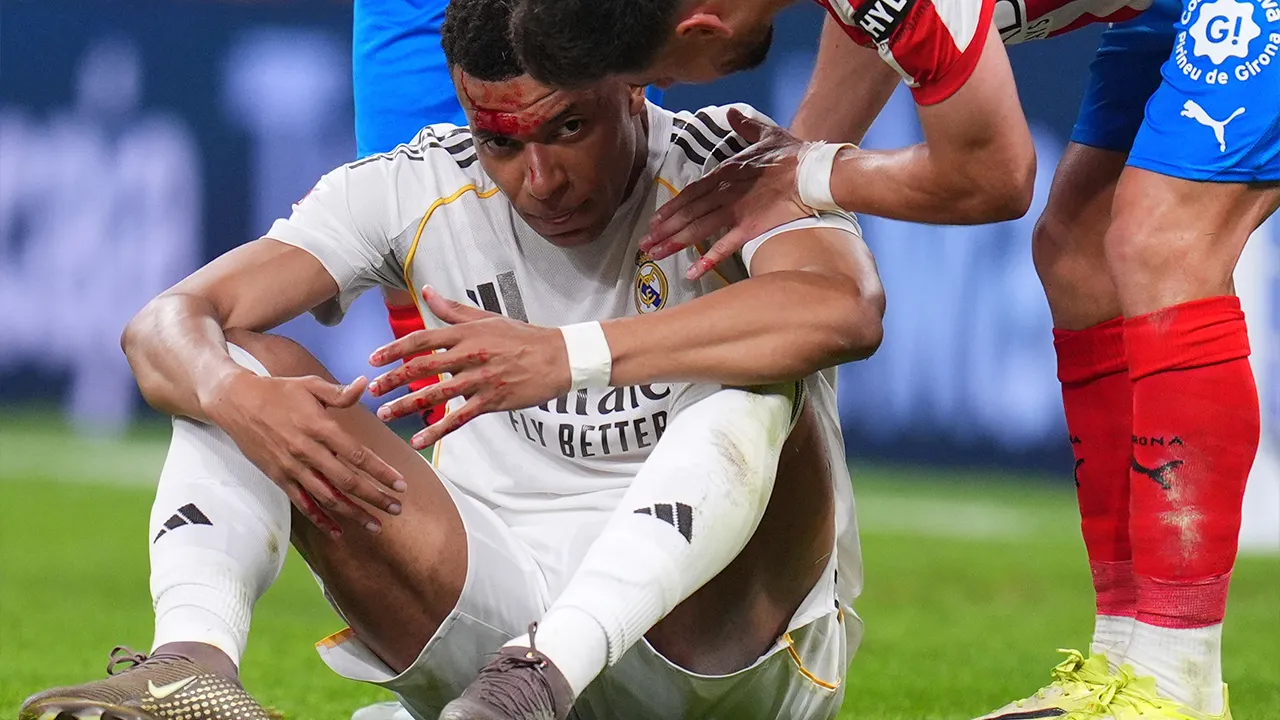  Real Madrid's Kylian Mbappe reacts during a Spanish La Liga soccer match between Real Madrid and Girona in Madrid, Spain, Friday, April 10, 2026. (AP Photo/Manu Fernandez)