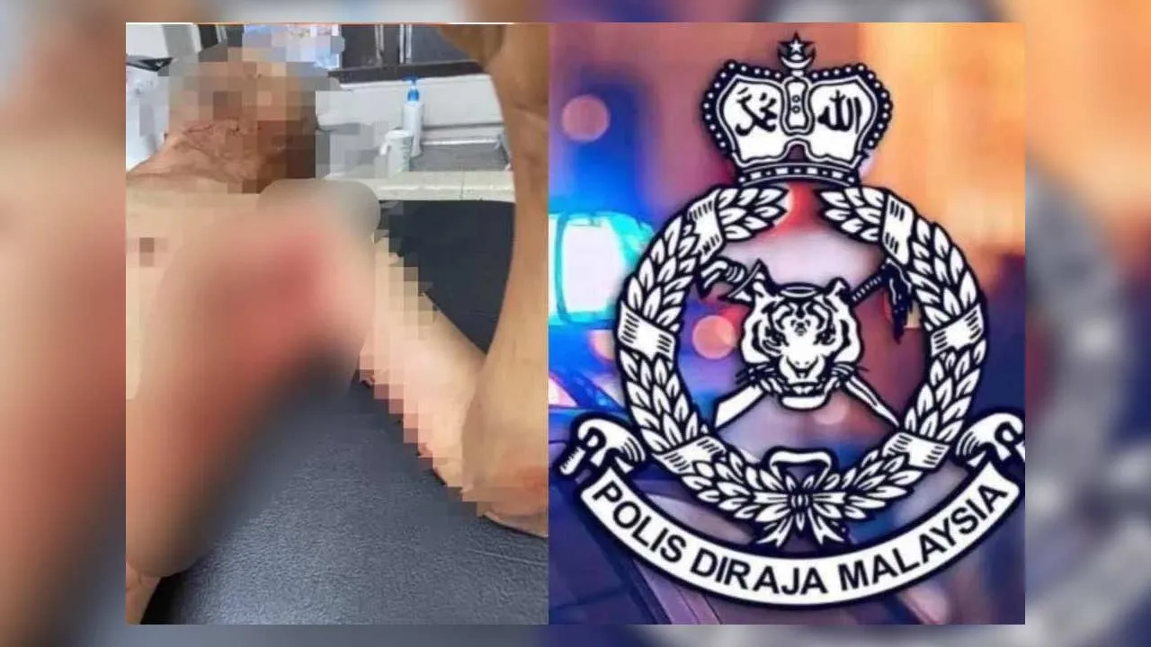 Seorang warga emas cedera pada bahagian ketiak kiri selepas ditanduk lembu dalam kejadian di Kampung Murni, Layang-layang, Kluang.- Foto tular