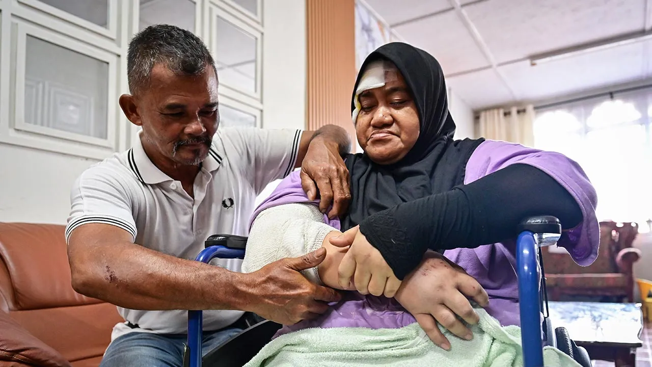 CHUKAI, 6 Ogos -- Mangsa, Abdul Wahid Ismail, 55, (kiri) melihat kecederaan pada tangan kanan isterinya, Fauziah Muda, 52, yang patah selepas kenderaan mereka merempuh sekumpulan gajah liar ketika ditemui di rumahnya di Kampung Pasir Gajah hari ini.  Pemandu kenderaan pelbagai guna (MPV) yang terlibat dalam kejadian merempuh sekumpulan gajah liar di Kilometer 274.6 Lebuhraya Pantai Timur 2 (LPT2) di sini Selasa lepas, meluahkan rasa kesal terhadap tahap keselamatan lebuh raya berkenaan yang didakwa gagal me