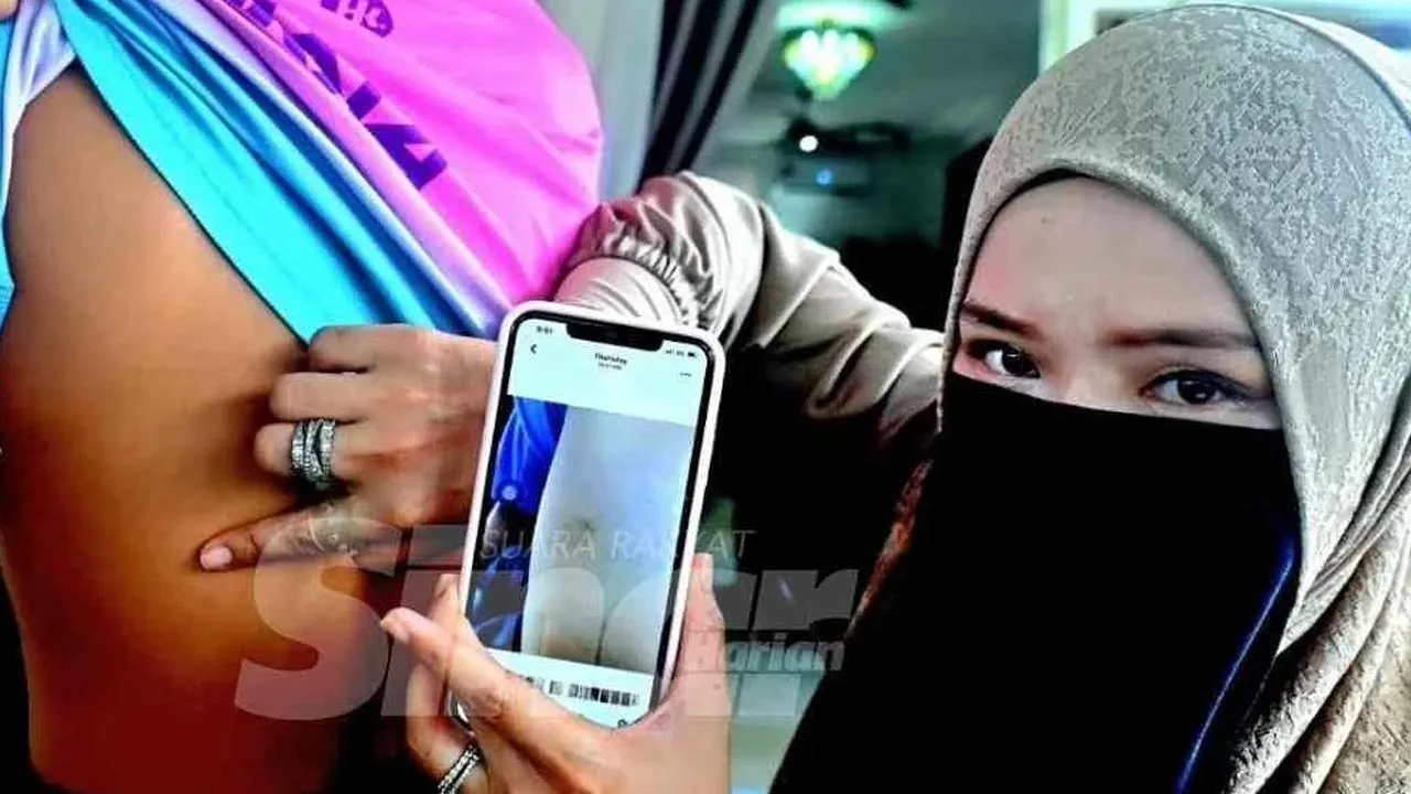 Rohani menunjukkan kesan kecederaan di bahagian belakang badan anaknya yang didakwa dipukul pelajar. -- SINAR HARIAN