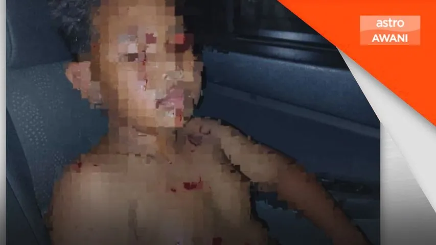 Mercun bola letup: Tujuh cedera, lelaki ditahan di Pendang