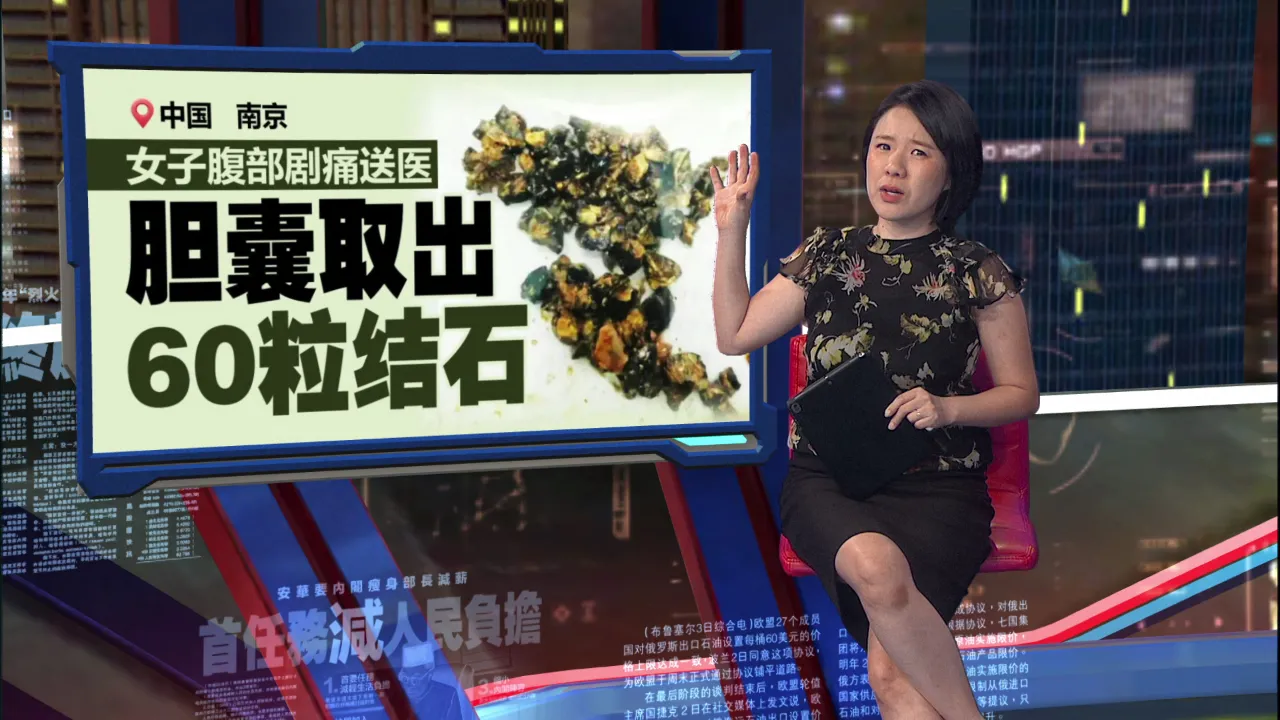早午晚餐不定时   女子胆囊取出60颗结石!