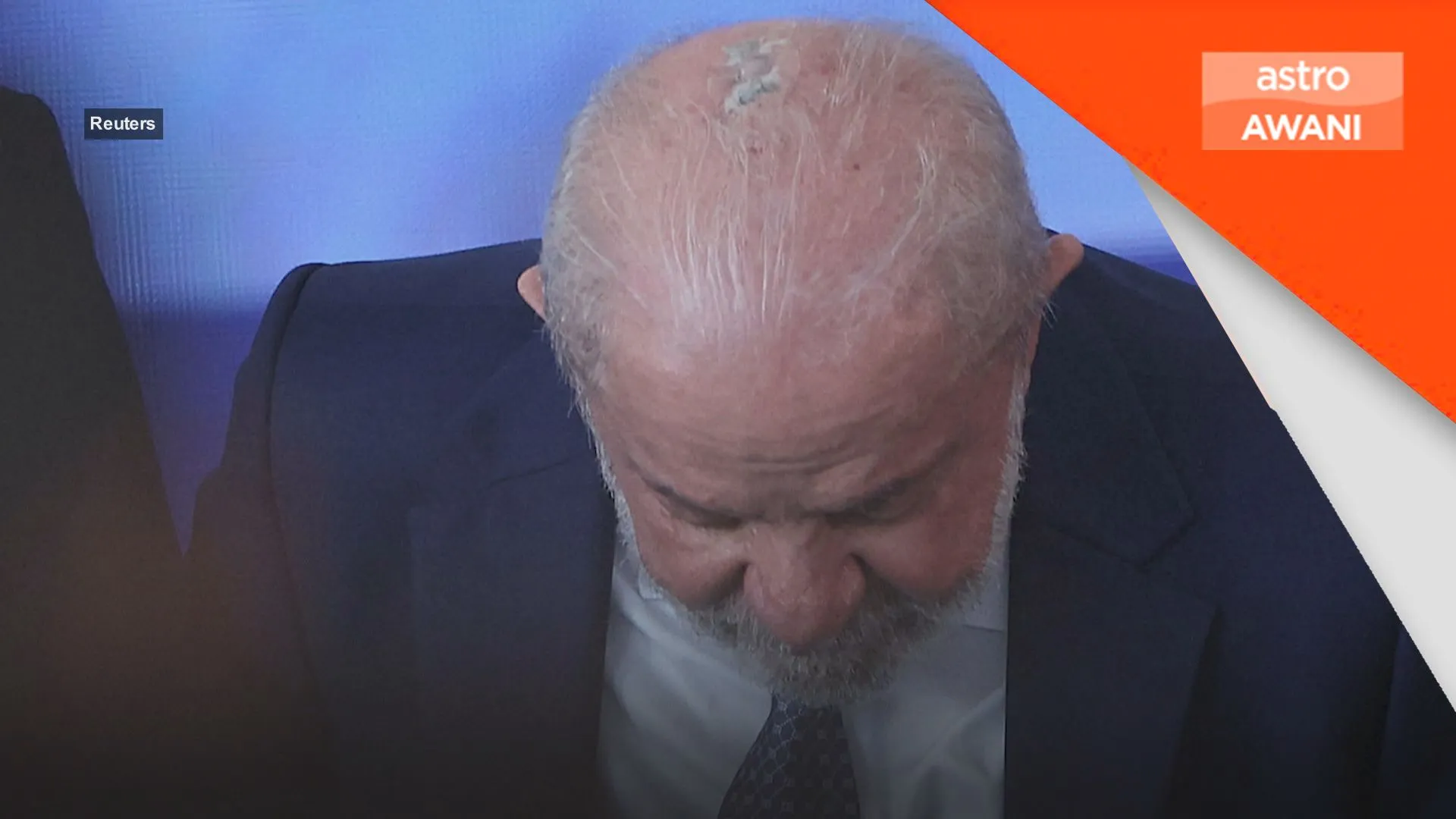 Presiden Brazil Lula jalani radioterapi, kanser kulit tahap awal