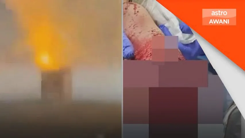 Lelaki putus kaki terkena letupan bunga api