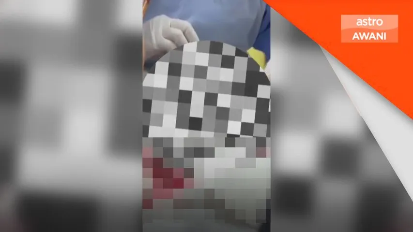 Remaja 17 tahun parah akibat mercun meletup di Springhill