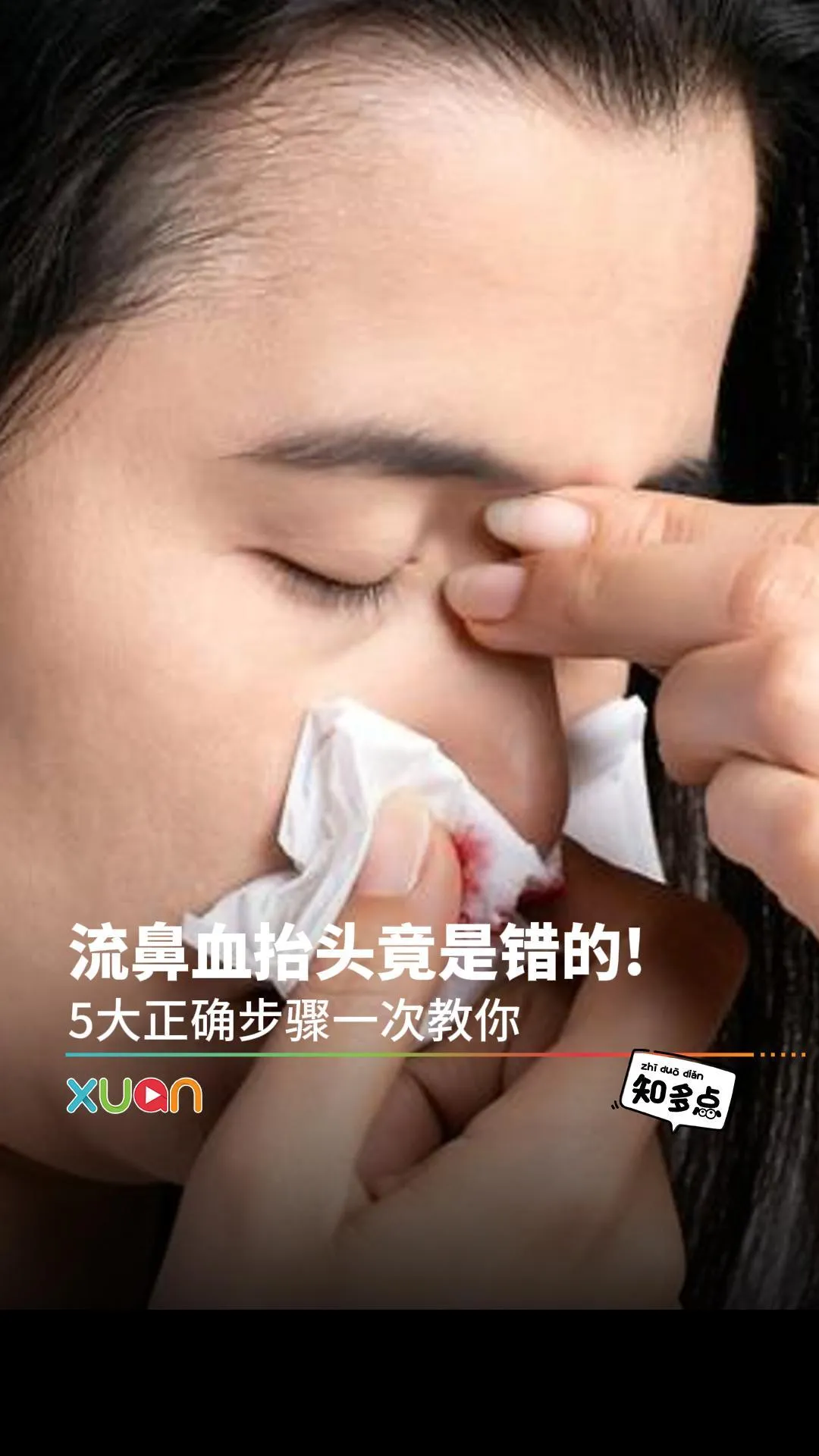流鼻血抬头竟是错的！5大正确步骤一次教你