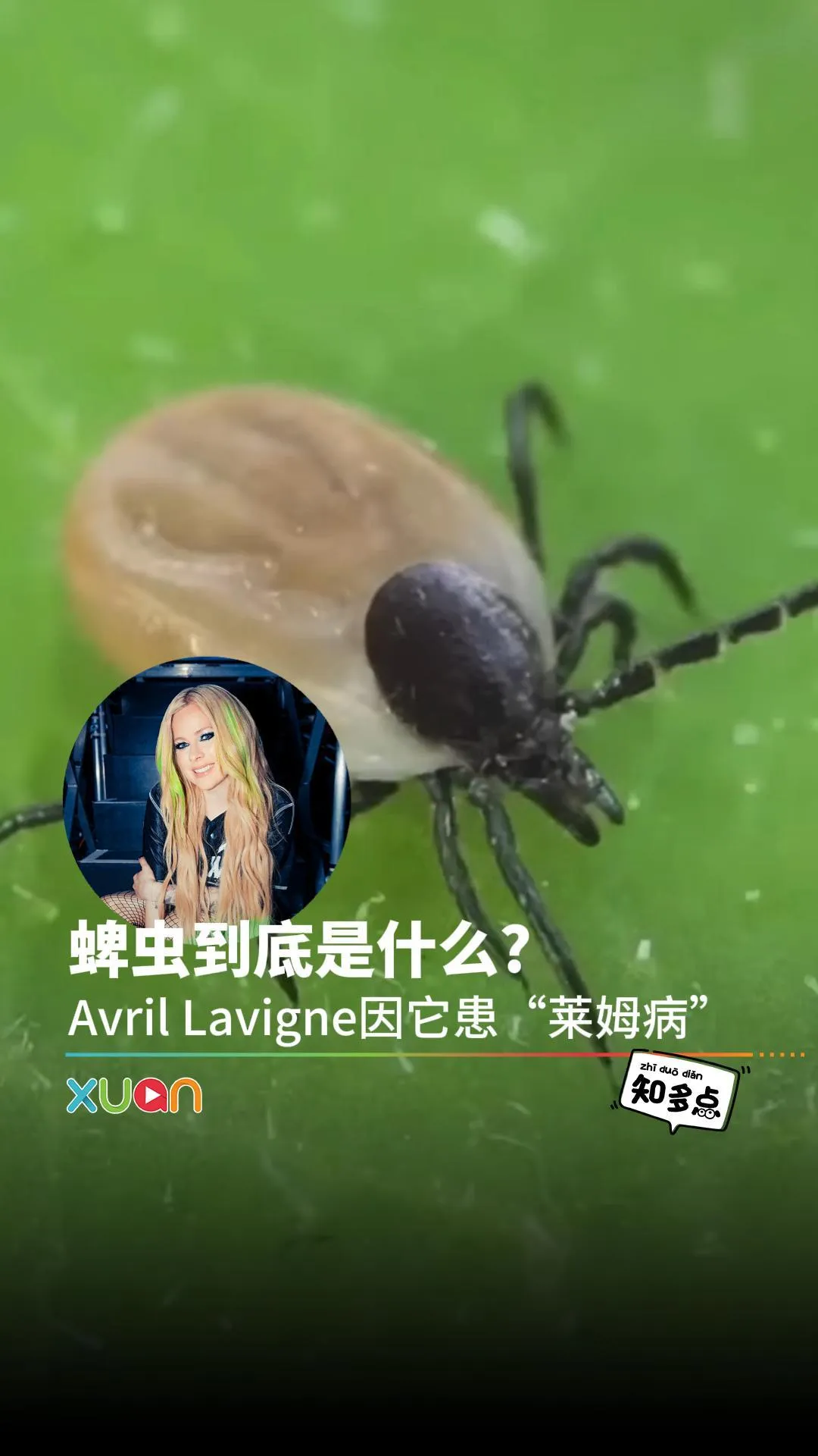 蜱虫到底是什么? Avril Lavigne因它患“莱姆病”